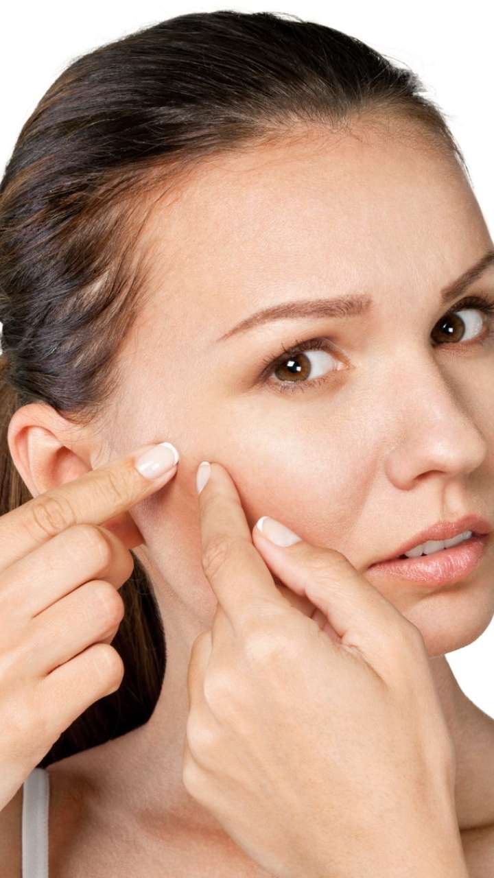 Benefits Of Applying Desi Ghee On Pimples